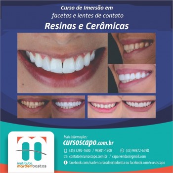 Curso de Imersão em Facetas e Lentes de Contato